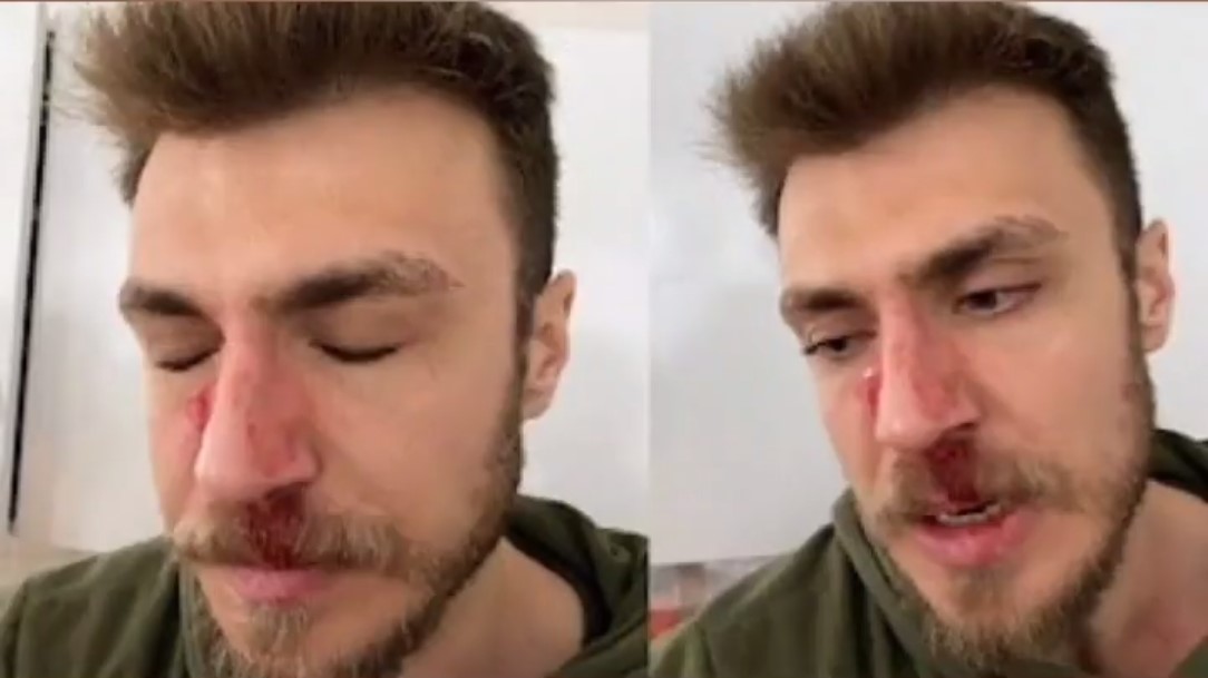 İzmir’de Suriyeli Hasta Yakını Doktorun Burnunu Kırdı ! Gündemi