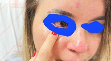 Doktor Saçlarından Sürüklenerek Darp Edildi !