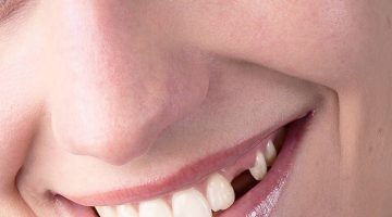 Anestezi Altında Diş Tedavisi Sadece Ameliyathanede Yapılmalı