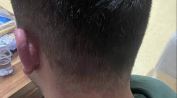 Şeker Bayramında Sağlık Personeli Darp Edildi ! 