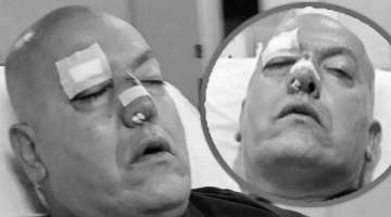 Samsun’da Doktora Şiddet ! Doktorun Burnu Kırıldı!