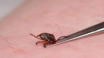 Sivas’ta Kene Can Aldı, 4 Kişi Öldü